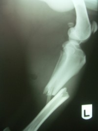 X-Ray Before Treatment